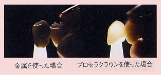 �I�[���Z���~�b�N�͓V�R���ƌ�����������قǎ��R�ȐF�ƋP���B���Ȃ��̎��ɍ��킹�Ă���I�[�_�[���C�h�N���E���B