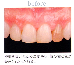 ���ÑO�b�I�[���Z���~�b�N