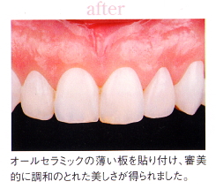 ���Ì�b�I�[���Z���~�b�N