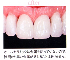 ���Ì�b�I�[���Z���~�b�N