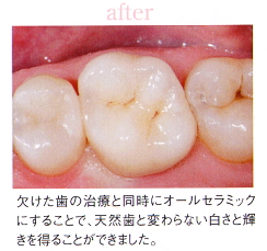 ���Ì�b�I�[���Z���~�b�N