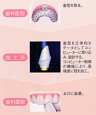 �����܂ł̗���b�I�[���Z���~�b�N�͂��Ȃ��̎��ɍ��킹�Ă���I�[�_�[���C�h�N���E��